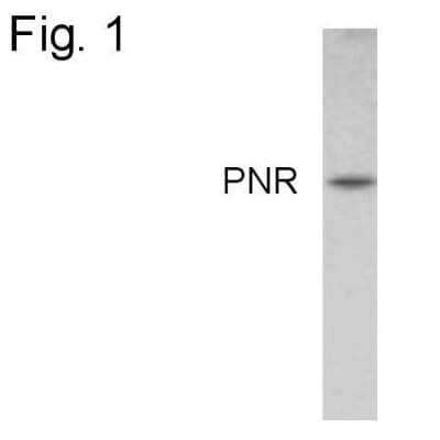 Western Blot: PNR/NR2E3 Antibody [NBP2-22466]