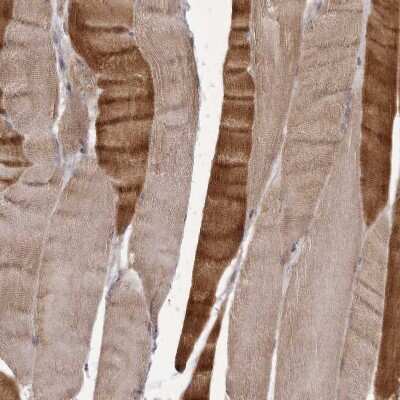 Immunohistochemistry-Paraffin: PNRC1 Antibody [NBP1-90837]