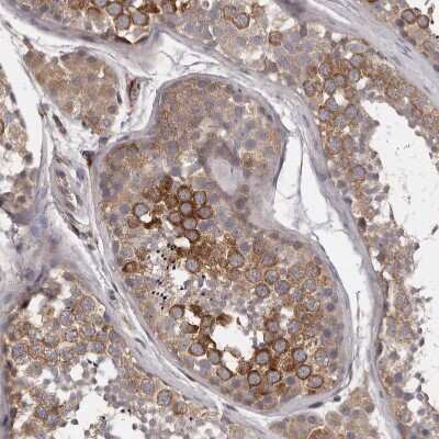 Immunohistochemistry-Paraffin: PNRC1 Antibody [NBP1-90837]