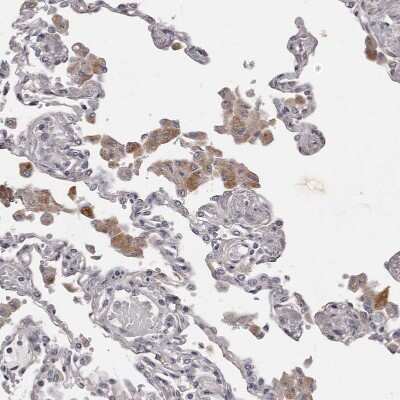 Immunohistochemistry-Paraffin: PNRC1 Antibody [NBP1-90837]