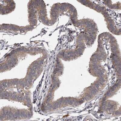 Immunohistochemistry-Paraffin: PNRC1 Antibody [NBP1-90837]