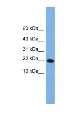 Western Blot: PNRC2 Antibody [NBP1-79660]