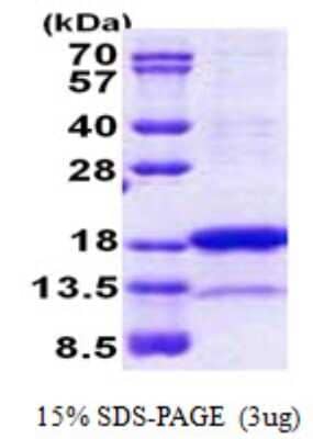 SDS-PAGE: Recombinant Human PNRC2 His Protein [NBP2-23367]