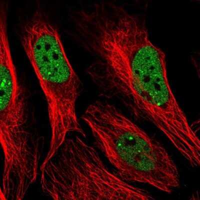 Immunocytochemistry/ Immunofluorescence: PNUTS/PPP1R10 Antibody [NBP2-38565]