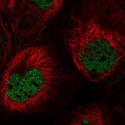 Immunocytochemistry/ Immunofluorescence: PNUTS/PPP1R10 Antibody [NBP2-38801]