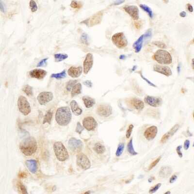 Immunohistochemistry: PNUTS/PPP1R10 Antibody [NB100-604]