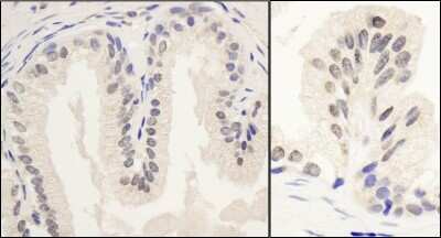 Immunohistochemistry: PNUTS/PPP1R10 Antibody [NB100-604]