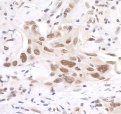 Immunohistochemistry: PNUTS/PPP1R10 Antibody [NB100-604]