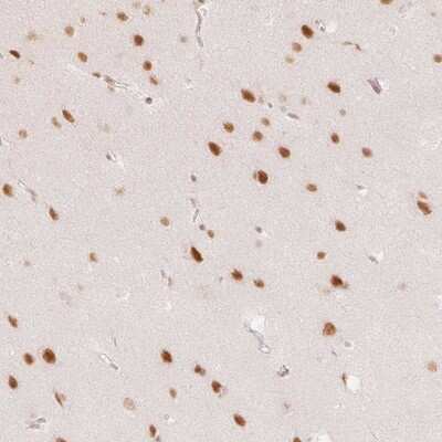 Immunohistochemistry: PNUTS/PPP1R10 Antibody [NBP2-38565]