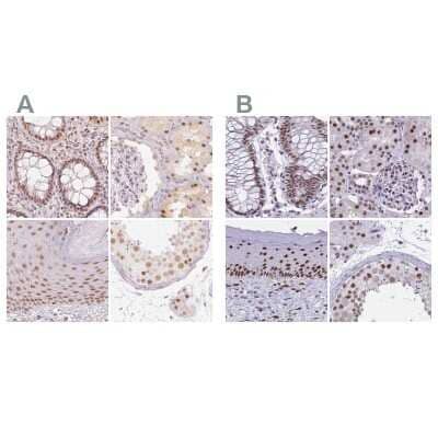 Immunohistochemistry-Paraffin: PNUTS/PPP1R10 Antibody [NBP2-38565]