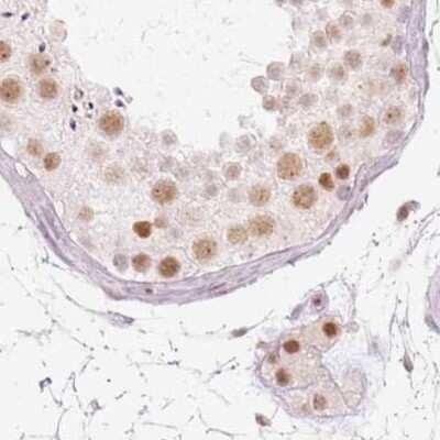 Immunohistochemistry-Paraffin: PNUTS/PPP1R10 Antibody [NBP2-38565]