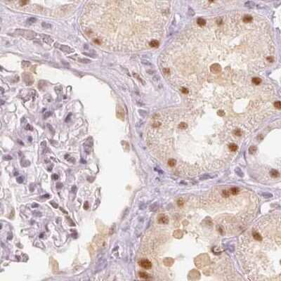 Immunohistochemistry-Paraffin: PNUTS/PPP1R10 Antibody [NBP2-38565]
