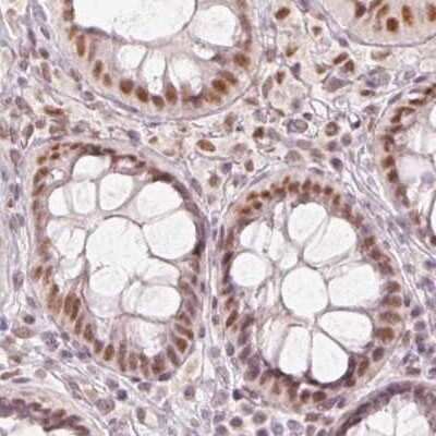 Immunohistochemistry-Paraffin: PNUTS/PPP1R10 Antibody [NBP2-38565]