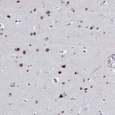 Immunohistochemistry-Paraffin: PNUTS/PPP1R10 Antibody [NBP2-38801]