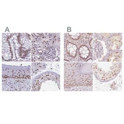 Immunohistochemistry-Paraffin: PNUTS/PPP1R10 Antibody [NBP2-38801]
