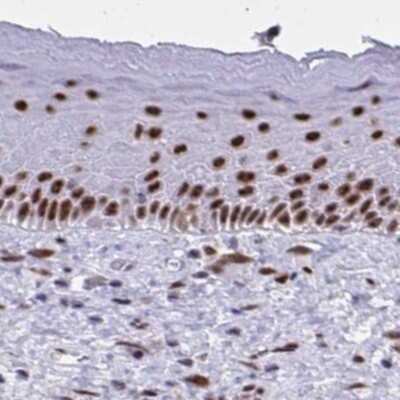 Immunohistochemistry-Paraffin: PNUTS/PPP1R10 Antibody [NBP2-38801]