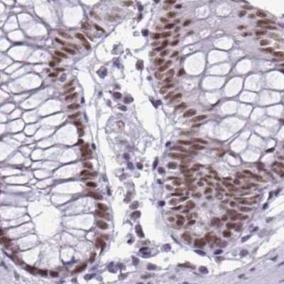 Immunohistochemistry-Paraffin: PNUTS/PPP1R10 Antibody [NBP2-38801]