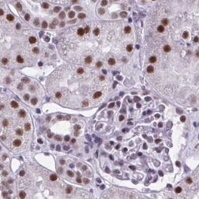 Immunohistochemistry-Paraffin: PNUTS/PPP1R10 Antibody [NBP2-38801]