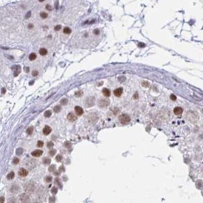 Immunohistochemistry-Paraffin: PNUTS/PPP1R10 Antibody [NBP2-38801]