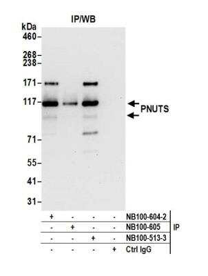 Immunoprecipitation: PNUTS/PPP1R10 Antibody [NB100-604]
