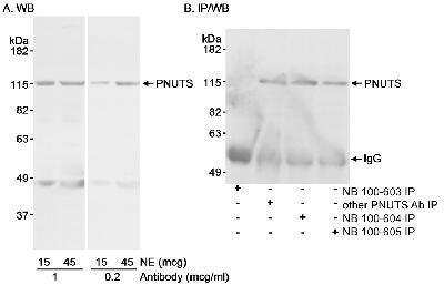 Western Blot: PNUTS/PPP1R10 Antibody [NB100-604]