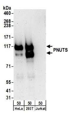 Western Blot: PNUTS/PPP1R10 Antibody [NB100-604]