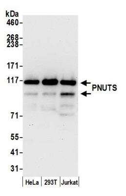 Western Blot: PNUTS/PPP1R10 Antibody [NB100-604]