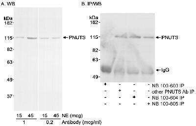 Western Blot: PNUTS/PPP1R10 Antibody [NB100-605]