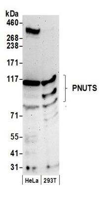 Western Blot: PNUTS/PPP1R10 Antibody [NB100-605]