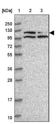 Western Blot: PNUTS/PPP1R10 Antibody [NBP2-38565]