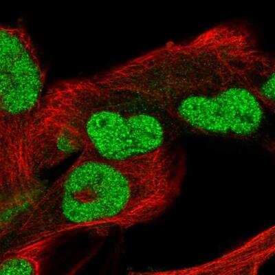 Immunocytochemistry/ Immunofluorescence: POC5 Antibody [NBP2-76555]