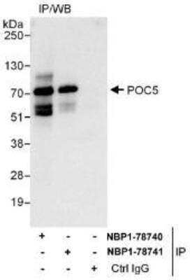 Immunoprecipitation: POC5 Antibody [NBP1-78740]