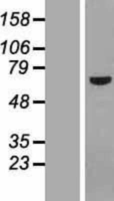 Western Blot: POC5 Overexpression Lysate [NBP2-05381]