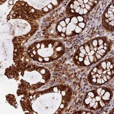 Immunohistochemistry-Paraffin: PODNL1 Antibody [NBP1-93930]