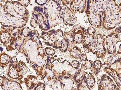 Immunohistochemistry-Paraffin: PODNL1 Antibody [NBP3-05990]