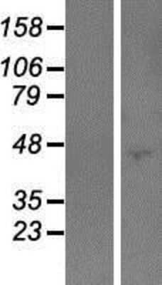 Western Blot: PODNL1 Overexpression Lysate [NBP2-06279]