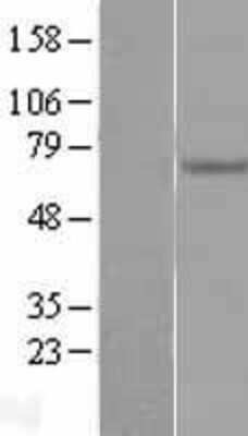 Western Blot: Endoglycan/PODXL2 Overexpression Lysate [NBL1-14563]