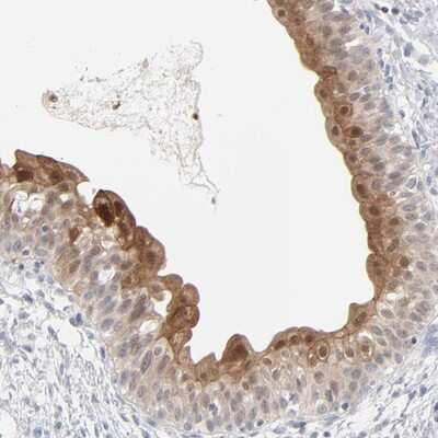 Immunohistochemistry-Paraffin: POF1B Antibody [NBP1-93938]