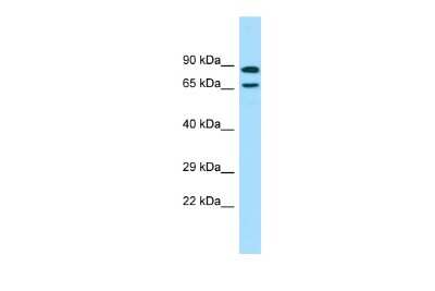 Western Blot: POF1B Antibody [NBP2-83406]