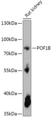 Western Blot: POF1B AntibodyAzide and BSA Free [NBP2-93152]