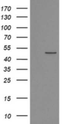 Western Blot: POFUT2 Antibody (OTI3A12) [NBP2-45363]