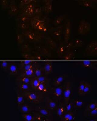 Immunocytochemistry/ Immunofluorescence: POFUT2 Antibody - Azide and BSA Free [NBP2-93894]