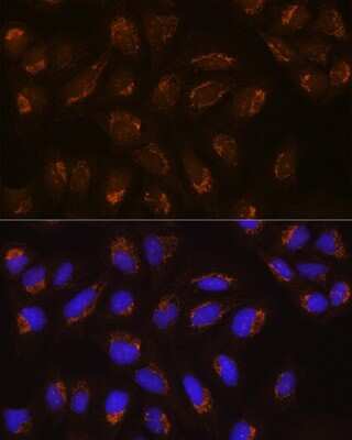 Immunocytochemistry/ Immunofluorescence: POFUT2 Antibody - Azide and BSA Free [NBP2-93894]