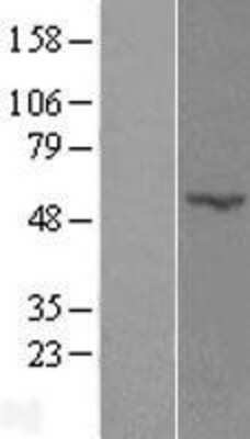 Western Blot: POFUT2 Overexpression Lysate [NBL1-14565]