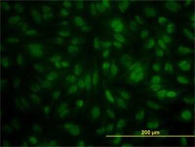 Immunocytochemistry/ Immunofluorescence: POGK Antibody (1A9) [H00057645-M01]