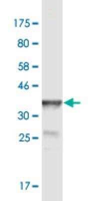 Western Blot: POGK Antibody (2D3) [H00057645-M02]