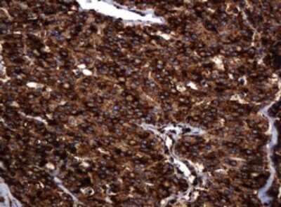 Immunohistochemistry: POGK Antibody (OTI6D5) [NBP2-45364]
