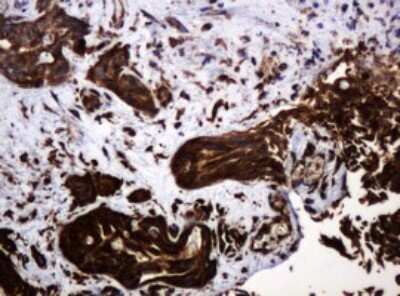Immunohistochemistry: POGK Antibody (OTI6D5) [NBP2-45364]