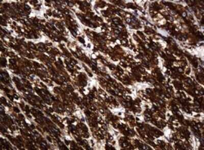 Immunohistochemistry: POGK Antibody (OTI6D5) [NBP2-45364]