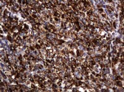 Immunohistochemistry: POGK Antibody (OTI6D5) [NBP2-45364]
